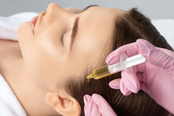 PRP Hair Treatment in Dubai