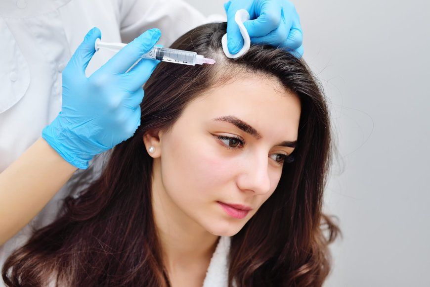 PRP hair treatment in Dubai