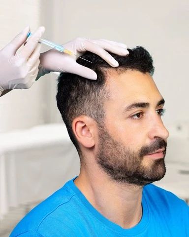 Hair Transplant in Dubai: Your Guide to Fuller Hair