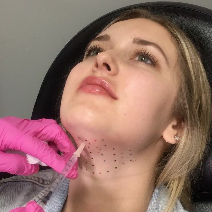 Fat melting injection in Dubai