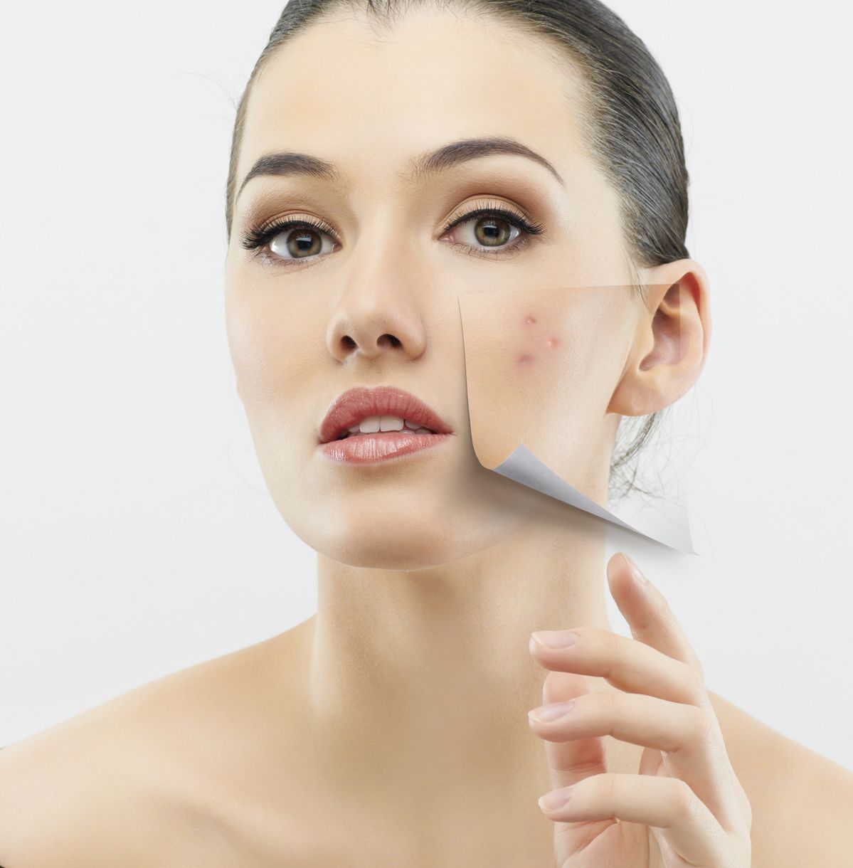 Scar Removal in Dubai