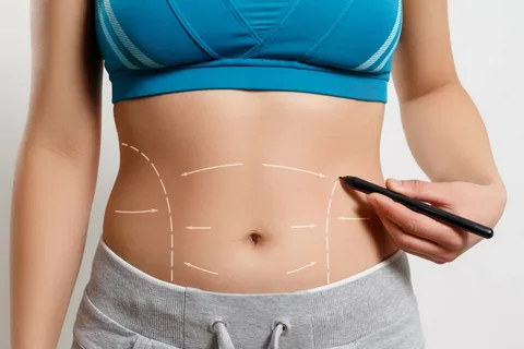 Tummy Tuck Surgery in Dubai