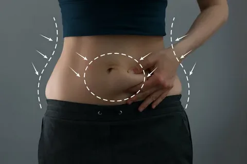 Tummy Tuck in Dubai