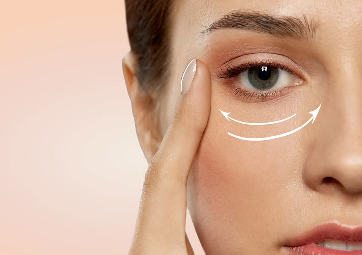 Eye Bag Removal in Dubai