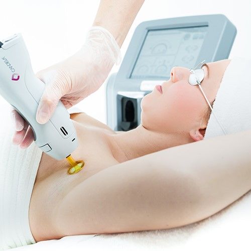 Laser Hair Removal in Dubai