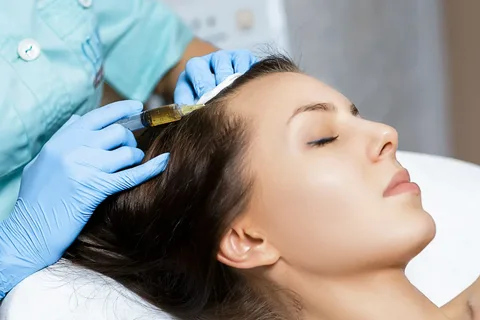 Hair Transplant in Dubai