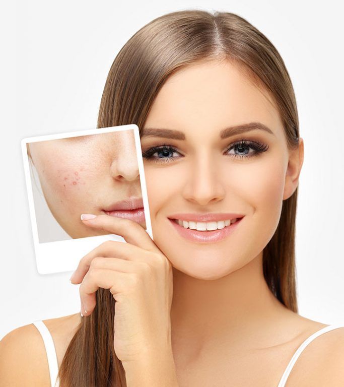 Scar Removal in Dubai