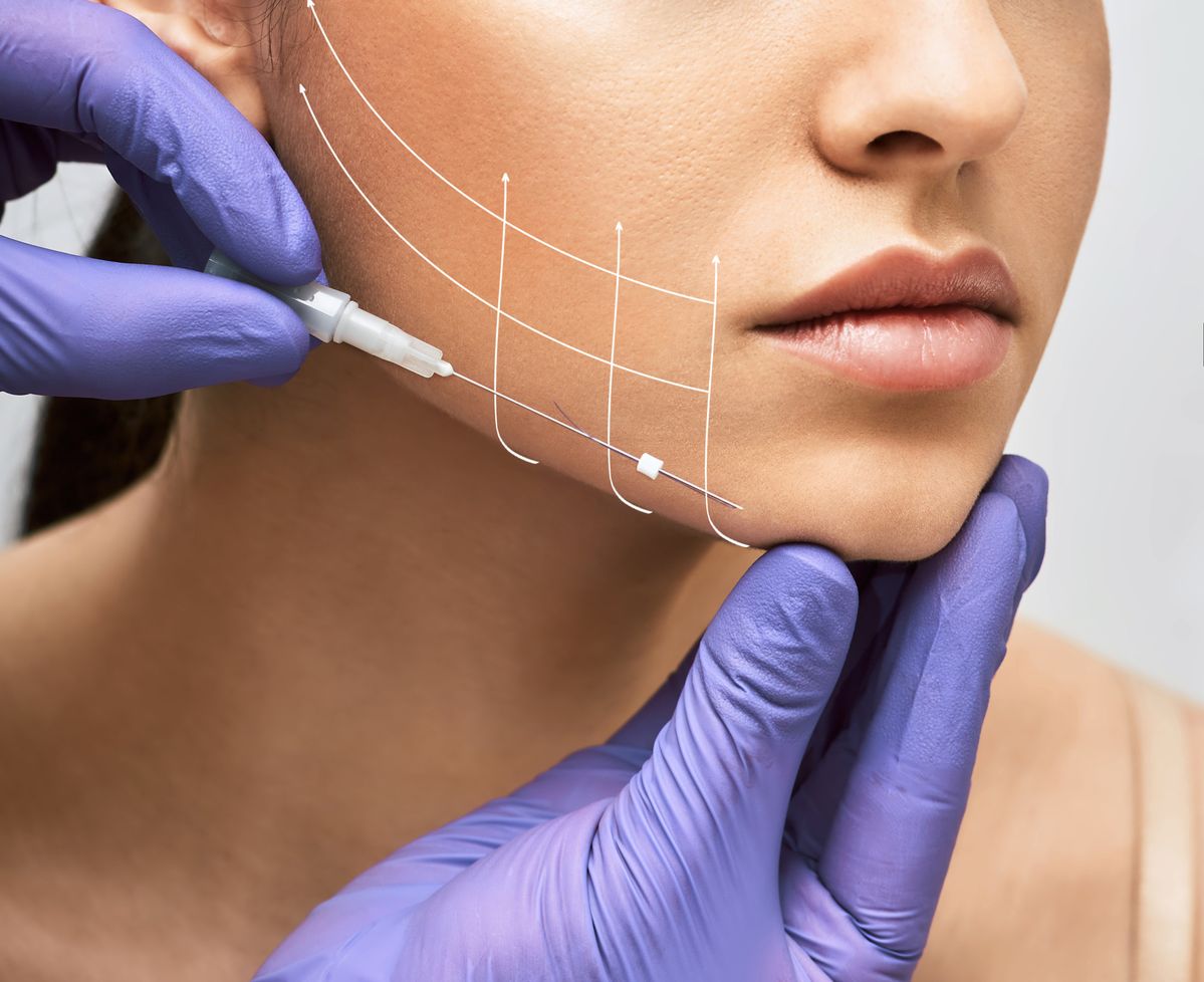 Facelift with Silhouette Threads in Dubai