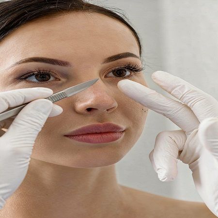 Rhinoplasty in Dubai