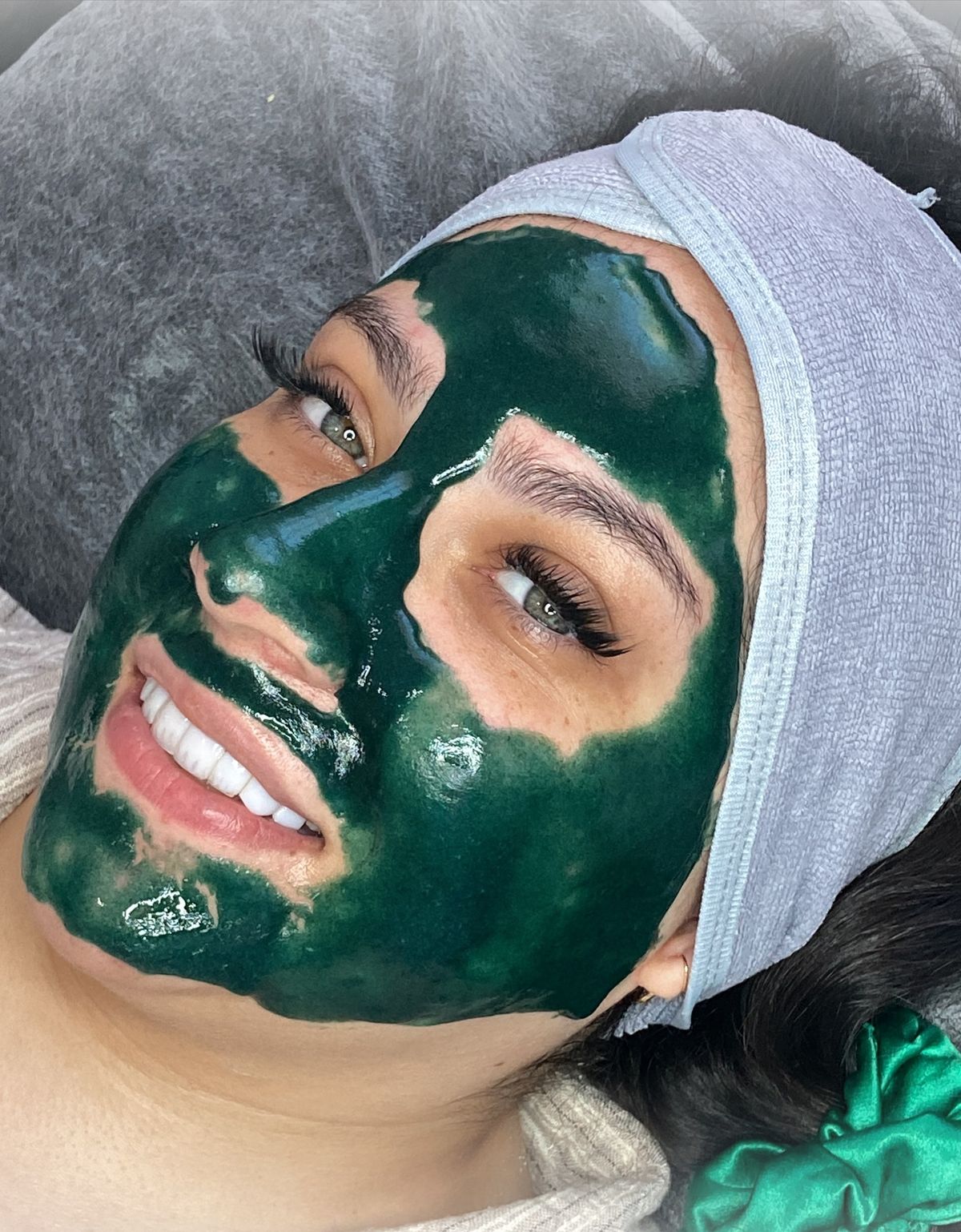 Green Peel Treatment in Dubai